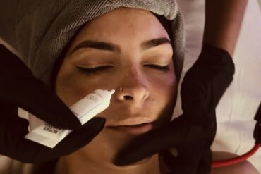 What to Expect: The Steps of a Chemical Peel Facial